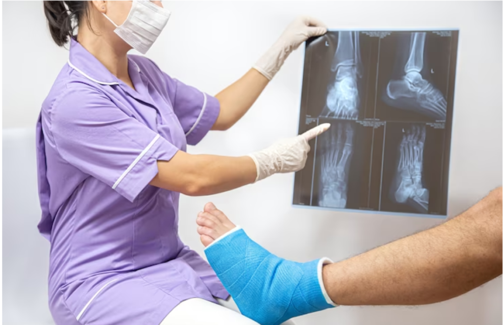Joint Replacement Surgery: Common Myths with a Hyderabad Specialist