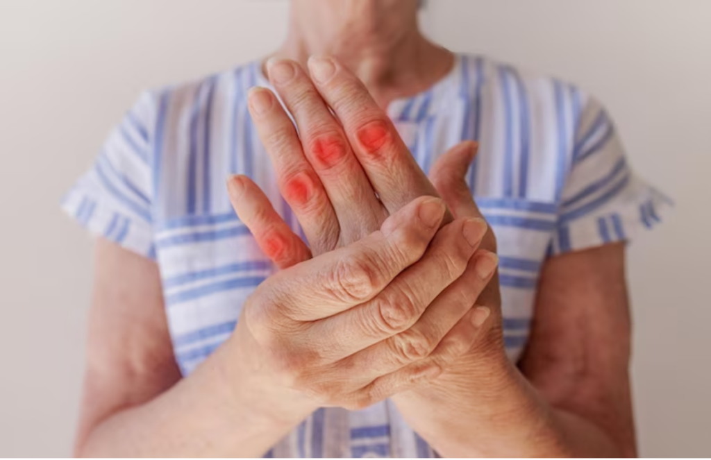 Rheumatoid Arthritis Treatments: Medications and Lifestyle Changes