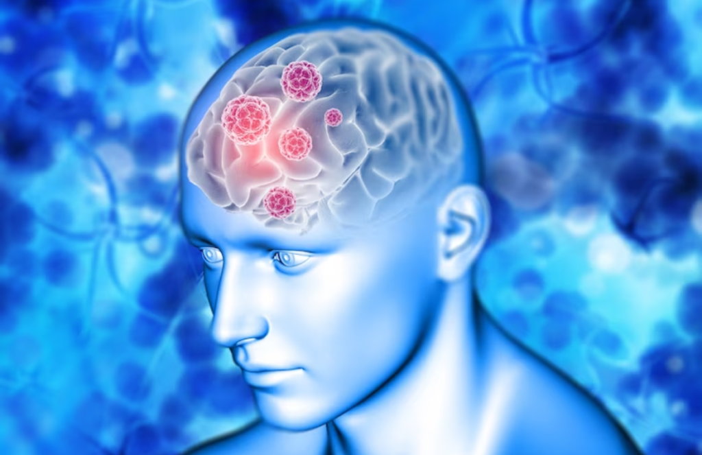 Neurological Disorders: Symptoms, Diagnosis, and Treatment