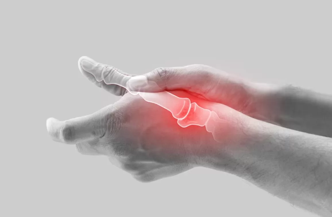 Pain after Exercise, Could Be Osteoarthritis