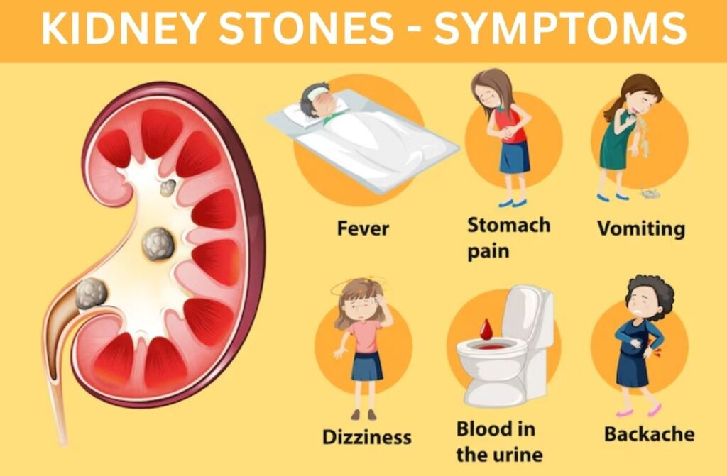 Kidney Stones Causes, Types, Symptoms, and Treatment